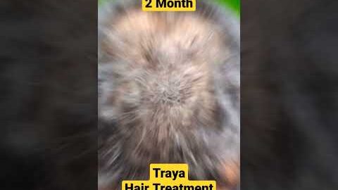 traya hair review #traya #trayahairkit