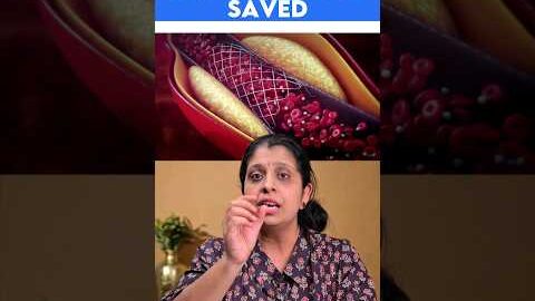 Heart attack – how patient is saved